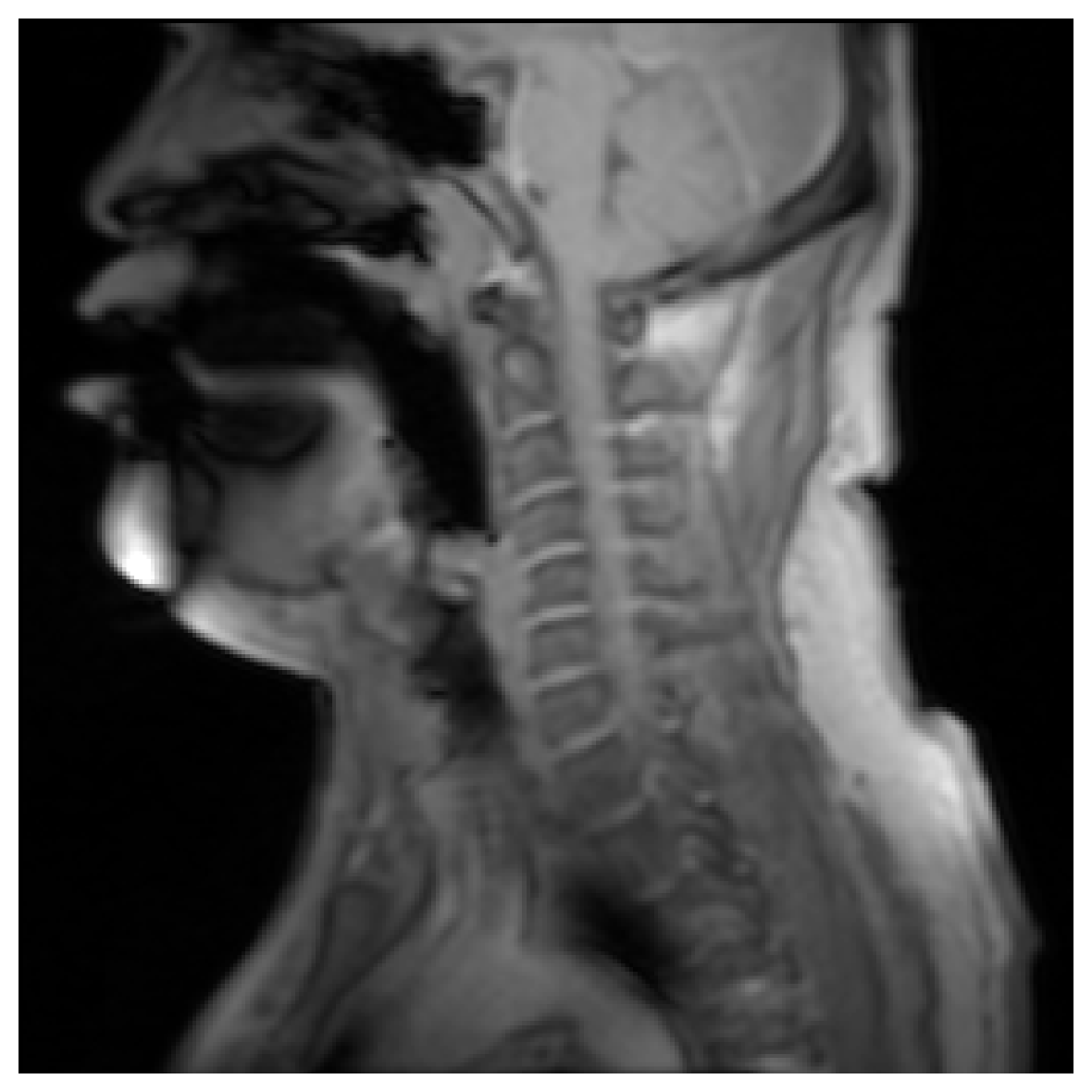 fMRI mean - stable