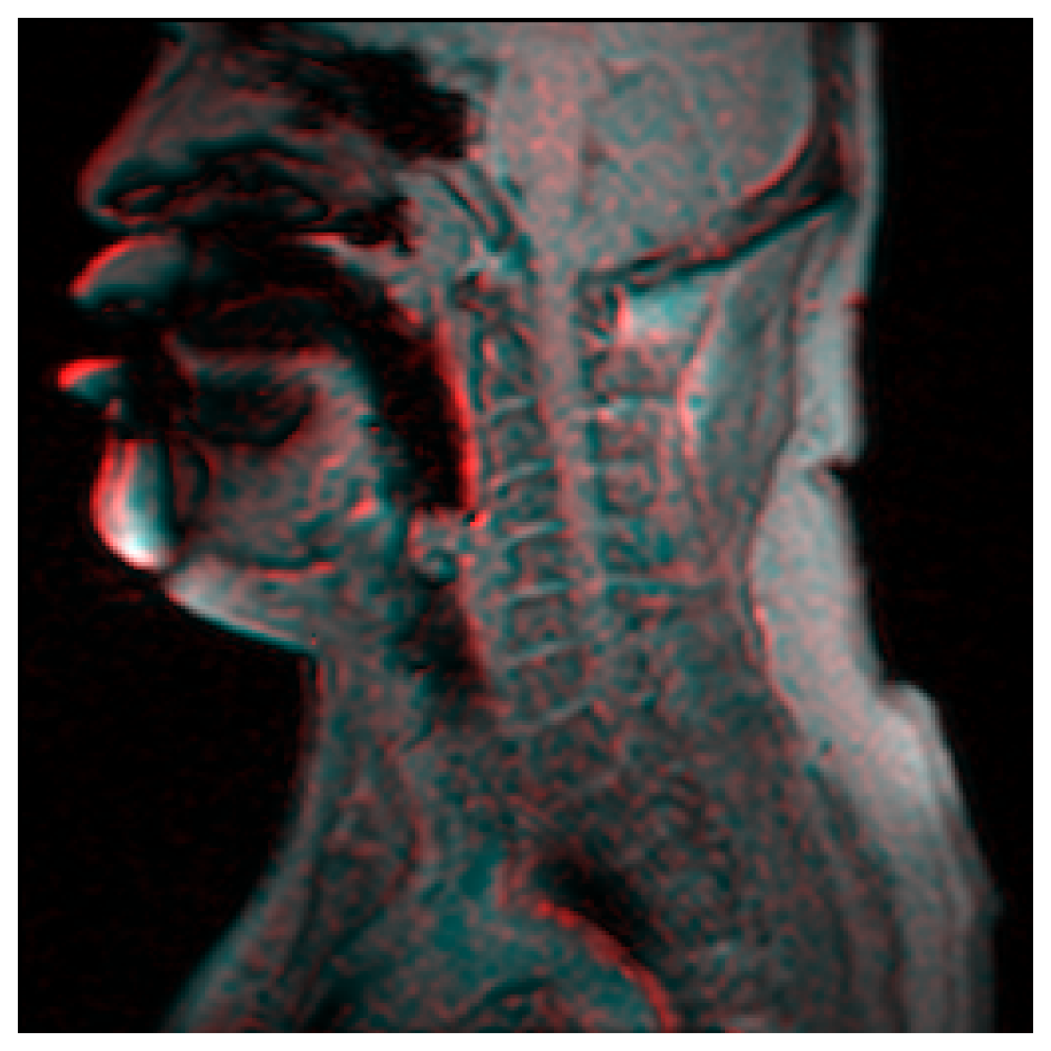 fMRI variation - stable