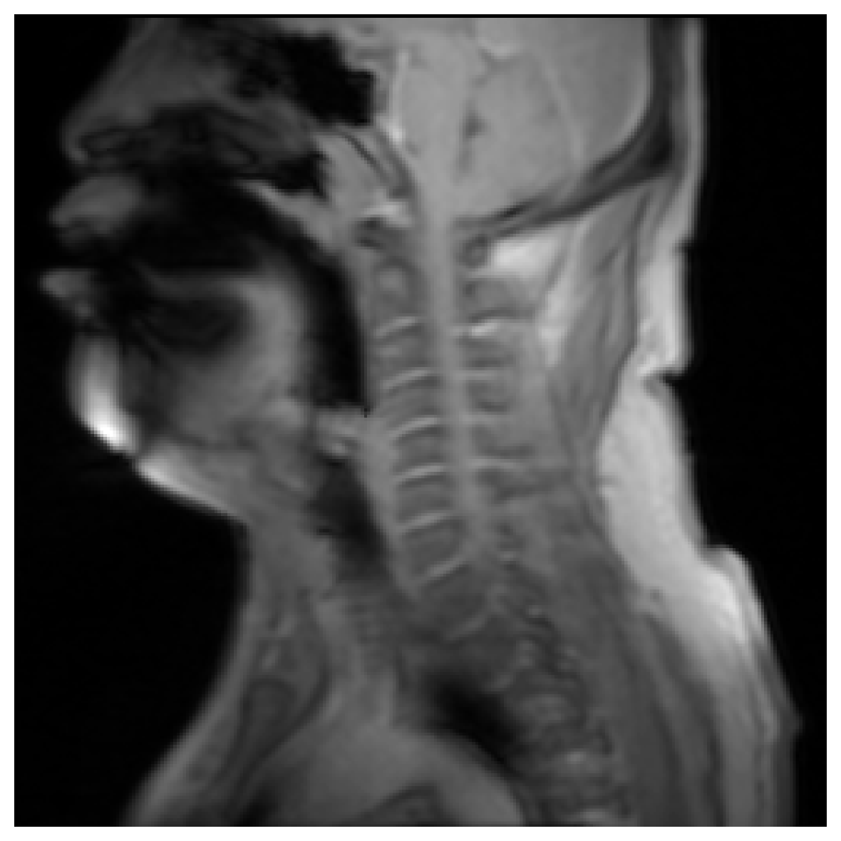 fMRI mean - vibrato