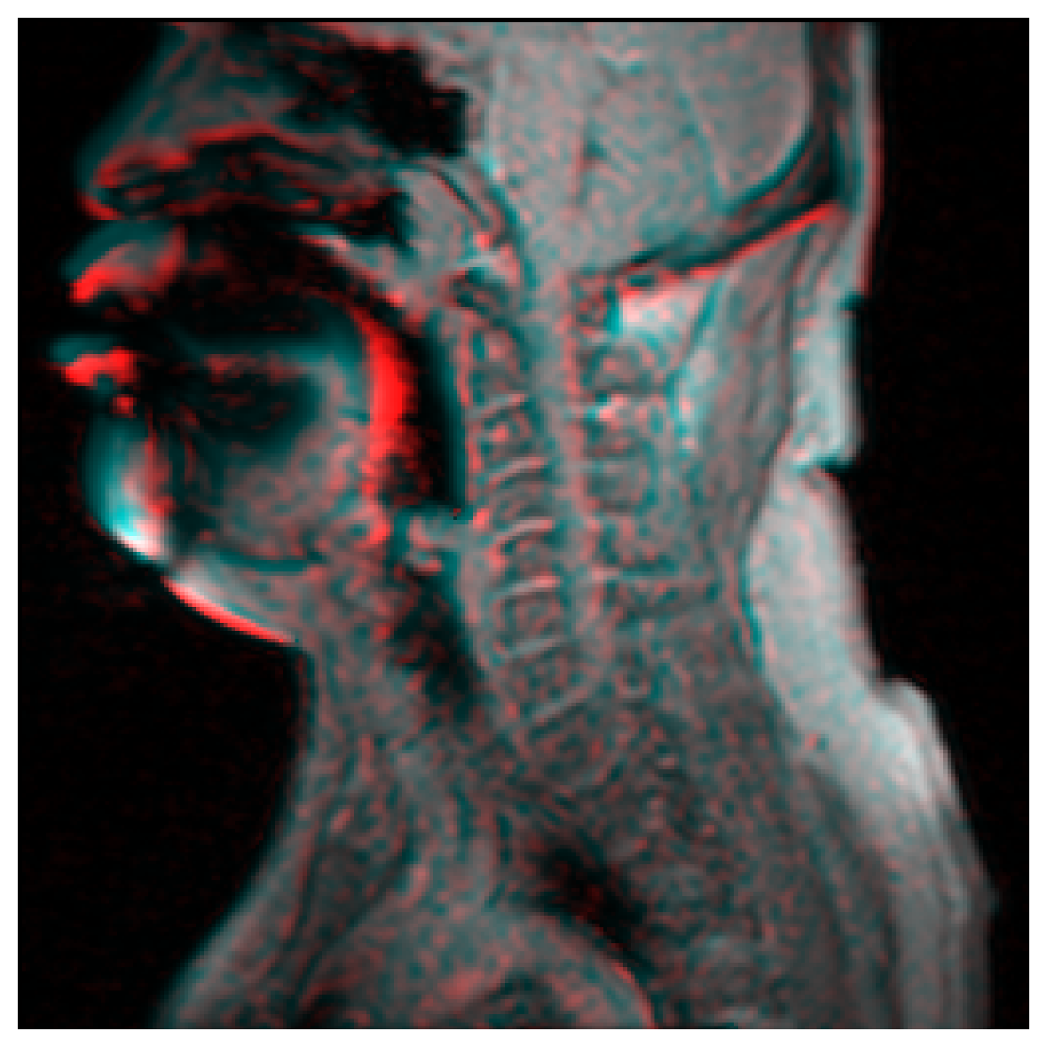 fMRI variation - vibrato